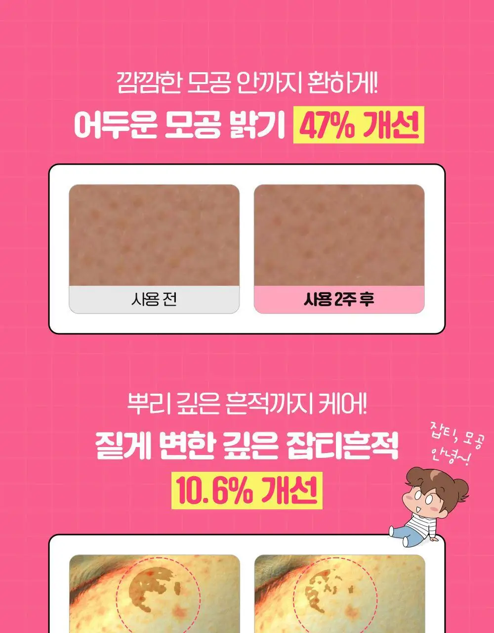 [잡티흔적] 차앤박 더마앤서 핑크토닝 딥인샷 PDRN앰플 30ml 기획 (+10ml) (아따맘마 콜라보) 상세페이지 14